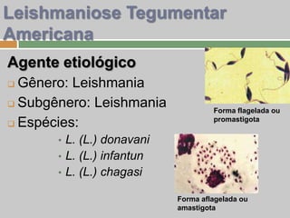Agente etiológico
 Gênero: Leishmania
 Subgênero: Leishmania
 Espécies:
• L. (L.) donavani
• L. (L.) infantun
• L. (L.) chagasi
Leishmaniose Tegumentar
Americana
Forma flagelada ou
promastigota
Forma aflagelada ou
amastigota
 