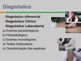  Diagnóstico diferencial
 Diagnóstico Clínico
 Diagnóstico Laboratorial
a) Exames parasitológicos;
b) Histopatológico;
c) Exames imunológicos;
d) Testes moleculares;
e) Caracterização das espécies.
Diagnóstico
 