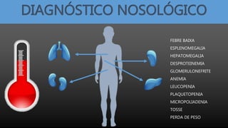 DIAGNÓSTICO NOSOLÓGICO
FEBRE BAIXA
ESPLENOMEGALIA
HEPATOMEGALIA
DESPROTEINEMIA
GLOMERULONEFRITE
ANEMIA
LEUCOPENIA
PLAQUETOPENIA
MICROPOLIADENIA
TOSSE
PERDA DE PESO
 