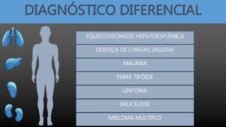 DIAGNÓSTICO DIFERENCIAL
EQUISTOSSOMOSE HEPATOESPLÊNICA
DOENÇA DE CHAGAS (AGUDA)
MALÁRIA
FEBRE TIFÓIDE
LINFOMA
BRUCELOSE
MIELOMA MÚLTIPLO
 