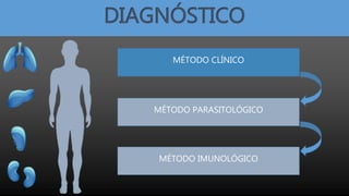 DIAGNÓSTICO
MÉTODO CLÍNICO
MÉTODO PARASITOLÓGICO
MÉTODO IMUNOLÓGICO
 