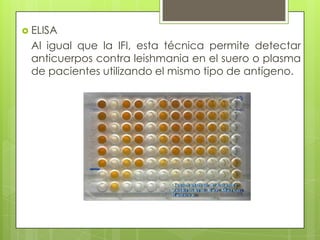  ELISA
 Al igual que la IFI, esta técnica permite detectar
 anticuerpos contra leishmania en el suero o plasma
 de pacientes utilizando el mismo tipo de antígeno.
 