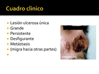 Cuadro clinicoLesión ulcerosa únicaGrandePersistenteDesfiguranteMetástasis (migra hacia otras partes)
