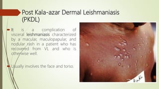 Leishmanisis. | PPTX