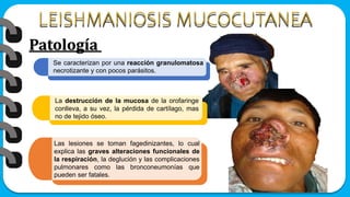 Patología
Se caracterizan por una reacción granulomatosa
necrotizante y con pocos parásitos.
La destrucción de la mucosa de la orofaringe
conlleva, a su vez, la pérdida de cartílago, mas
no de tejido óseo.
Las lesiones se toman fagedinizantes, lo cual
explica las graves alteraciones funcionales de
la respiración, la deglución y las complicaciones
pulmonares como las bronconeumonías que
pueden ser fatales.
 