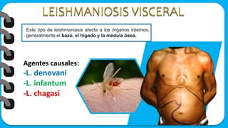 Agentes causales:
-L. denovani
-L. infantum
-L. chagasi
Este tipo de leishmaniasis afecta a los órganos internos,
generalmente el bazo, el hígado y la médula ósea.
 