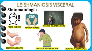 Sintomatología
FIEBRE CRONICA PERDIDA DE PESO
HEPATOESPLENOMEGALIA
EDEMA EN LOS MMII
RETARDO DEL CRECIMIENTO
TUBERCULOSIS-NEUMONIA
 