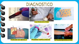 CULTIVOS IN VITRO
PUNCION DE MEDULA INTRADERMORREACION
PRUEBAS SEROLOGICAS
 