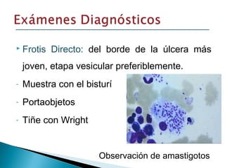  Frotis Directo: del borde de la úlcera más
joven, etapa vesicular preferiblemente.
- Muestra con el bisturí
- Portaobjetos
- Tiñe con Wright
Observación de amastigotos
 