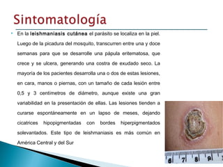  En la leishmaniasis cutánea el parásito se localiza en la piel.
Luego de la picadura del mosquito, transcurren entre una y doce
semanas para que se desarrolle una pápula eritematosa, que
crece y se ulcera, generando una costra de exudado seco. La
mayoría de los pacientes desarrolla una o dos de estas lesiones,
en cara, manos o piernas, con un tamaño de cada lesión entre
0,5 y 3 centímetros de diámetro, aunque existe una gran
variabilidad en la presentación de ellas. Las lesiones tienden a
curarse espontáneamente en un lapso de meses, dejando
cicatrices hipopigmentadas con bordes hiperpigmentados
solevantados. Este tipo de leishmaniasis es más común en
América Central y del Sur
 