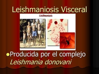 Leishmaniosis Visceral
Producida por el complejo
Leishmania donovani
 