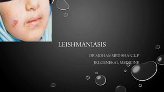 LEISHMANIASIS
DR.MOHAMMED SHANIL.P
JR1,GENERAL MEDICINE
 