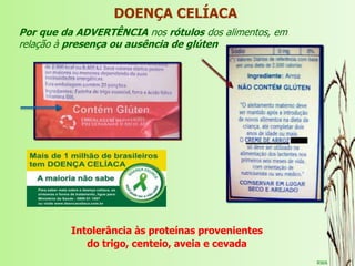 RWA
Por que da ADVERTÊNCIA nos rótulos dos alimentos, em
relação à presença ou ausência de glúten
DOENÇA CELÍACA
Intolerância às proteínas provenientes
do trigo, centeio, aveia e cevada
 