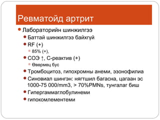 Ревматойд артрит
Лабораторийн шинжилгээ
Баттай шинжилгээ байхгүй
RF (+)
 85% (+),

СОЭ ↑, С-реактив (+)
 Өвөрмөц бус
Тромбоцитоз, гипохромны анеми, эзонофилиа
Синовиал шингэн: нягтшил багасна, цагаан эс

1000-75 000/mm3, > 70%PMNs, тунгалаг биш
Гипергаммаглобулинеми
гипокомлементеми

 