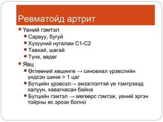 Ревматойд артрит
Үений гэмтэл
Сарвуу, бугуй
Хүзүүний нугалам С1-С2
Тавхай, шагай
Түнх, өвдөг

Явц
Өглөөний хөшингө → синовиал үрэвслийн

үндсэн шинж > 1 цаг
Бүтцийн үрэвсэл→ эмзэглэлтэй үе тэмтрэхэд
халуун, хавагнасан байна
Бүтцийн гэмтэл → мөгөөрс гэмтэж, үений эргэн
тойрны яс эрози болно

 