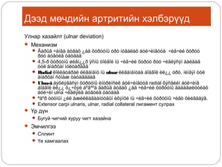 Дээд мөчдийн артритийн хэлбэрүүд
Улнар хазайлт (ulnar deviation)
 Механизм
 Ãàðûã ÷àíãà àòãàõ ¿åä õóðóóíû óðò íóãàëàõ áóë÷èíãóóä ÷èã÷èé õóðóó
ðóó áóãóéã òàòäàã
 4,5-ð õóðóóíû øèâí¿¿ð ÿñíû òîëãîé íü ÷èã÷èé õóðóó ðóó ÷èãëýñýí áàéäàã
òóë àìàðõàí ìóëòàðäàã
 Radial êîëëàòåðàë ëèãàìåíò íü ulnar ëèãàìåíòàà áîäâîë èë¿¿ óðò, íèìãýí òóë
àìàðõàí ñóíàæ òàòàãääàã
 Ulna-ä áýõëýãäñýí õóðóóíû èíòðèíñèê áóë÷èíãóóä radiàl õýñãèéí áóë÷èíã
áîäâîë èë¿¿ õ¿÷òýé áºãººä ãàðûã àòãàõ ¿åä ÷èã÷èé õóðóóíû ãàäàãøëóóëàõ
áóë÷èí ulna ÷èãëýëä áóãóéã òàòäàã
 ªäºð òóòìûí ¿éë àæèëëàãààíóóäûí èõýíõè íü ÷èã÷èé õóðóóíû ÷èãò õèéãääýã.
 Extensor carpi ulnaris, ulnar, radial collateral лигамент сулрах
 Үр дүн
 Бугуй чигчий хуруу чигт хазайна

 Эмчилгээ
 Сплинт
 Үе хамгаалах

 