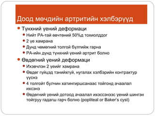 Доод мөчдийн артритийн хэлбэрүүд
 Түнхний үений деформаци
 Нийт РА-тай өвчтөний 50%д тохиолддог
 2 үе хамрана
 Дунд чөмөгний толгой бүлтийж гарна
 РА-ийн дүнд түнхний үений артрит болно
 Өвдөгний үений деформаци
 Ихэвчлэн 2 үеийг хамрана
 Өвдөг гүйцэд тэнийхгүй, нугалах хэлбэрийн контрактур

үүснэ
 4 толгойт булчин хатингиршсанаас тойгонд ачаалал
ихсэнэ
 Өвдөгний үений дотоод ачаалал ихэссэнээс үений шингэн
тойгруу гадагш гарч болно (popliteal or Baker’s cyst)

 