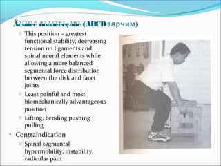 Äèíàìèê ñòàáèëèçàöè (ABCD зарчим)
o This position – greatest

functional stability, decreasing
tension on ligaments and
spinal neural elements while
allowing a more balanced
segmental force distribution
between the disk and facet
joints
o Least painful and most
biomechanically advantageous
position
o Lifting, bending pushing
pulling

• Contraindication
o Spinal segmental
hypermobility, instability,
radicular pain

 