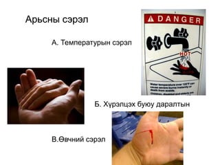 Арьсны сэрэл
А. Температурын сэрэл
Б. Хүрэлцэх буюу даралтын
В.Өвчний сэрэл
 