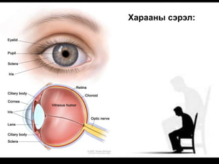 Харааны сэрэл:
 