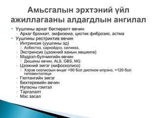 


Уушгины архаг бөглөрөлт өвчин
◦ Архаг бронхит, эмфизема, цистик фиброзис, астма
Уушгины рестриктив өвчин
◦ Интринсик (уушгины эд)
 Асбестоз, саркойдоз, силикоз,

◦ Экстринсик (цээжний ханын хөшингө)
◦ Мэдрэл-булчингийн өвчин
 Дюшены өвчин, ALS, GBS, MG

◦ Цээжний эмгэг (кифосколиоз)
◦
◦
◦
◦
◦

 Хэрэв сколиозын өнцөг >90 бол диспное илрэнэ, >120 бол
гиповентиляци

Гялтангийн эмгэг
Бехтеревийн өвчин
Нугасны гэмтэл
Таргалалт
Мэс засал

 