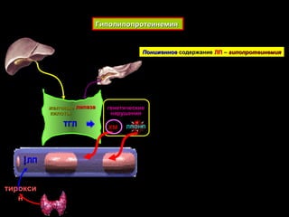 ГиполипопротеинемияГиполипопротеинемия
желчныежелчные
килотыкилоты
липазалипаза
ЛПЛП
ХМХМ ЛПОНПЛПОНПТГЛТГЛ
ПониженноеПониженное содержаниесодержание ЛПЛП –– гипопротеинемиягипопротеинемия
тирокситирокси
нн
генетическиегенетические
нарушениянарушения
 
