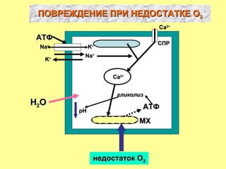 ПОВРЕЖДЕНИЕ ПРИ НЕДОСТАТКЕ ОПОВРЕЖДЕНИЕ ПРИ НЕДОСТАТКЕ О22
NaNa++
KK++
АТФАТФ
KK++ NaNa++
ССaa22++
ФЛ АФЛ А22
ССaa22++
МХМХ
НН22ОО
СПРСПР
АТФАТФрНрН
недостаток Онедостаток О22
гликолизгликолиз
 