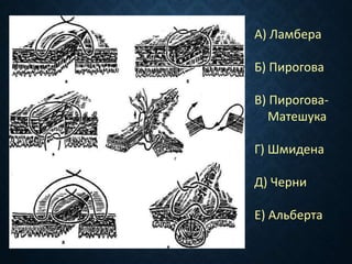 А) Ламбера
Б) Пирогова
В) Пирогова-
Матешука
Г) Шмидена
Д) Черни
Е) Альберта
 