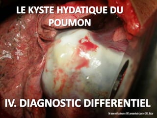 Dr innocent kashongwe, DES pneumologie, janvier 2011, Dakar
 