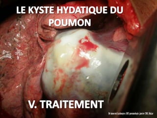 Dr innocent kashongwe, DES pneumologie, janvier 2011, Dakar
 