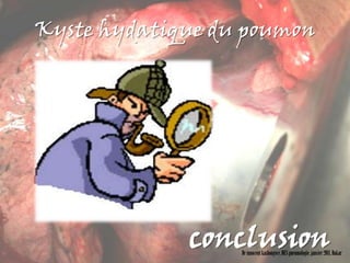 Kyste hydatique du poumon




             conclusion
                  Dr innocent kashongwe, DES pneumologie, janvier 2011, Dakar
 