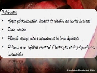 Dr innocent kashongwe, DES pneumologie, janvier 2011, Dakar
 