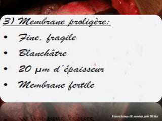 Dr innocent kashongwe, DES pneumologie, janvier 2011, Dakar
 