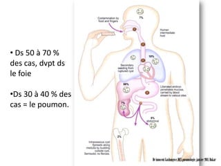• Ds 50 à 70 %
des cas, dvpt ds
le foie

•Ds 30 à 40 % des
cas = le poumon.




                    Dr innocent kashongwe, DES pneumologie, janvier 2011, Dakar
 