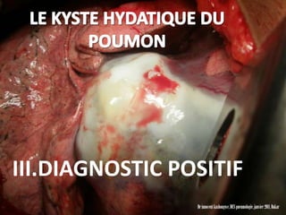 III.DIAGNOSTIC POSITIF
                 Dr innocent kashongwe, DES pneumologie, janvier 2011, Dakar
 