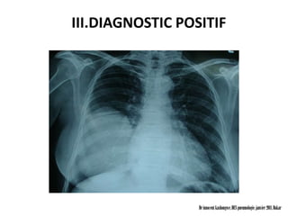 III.DIAGNOSTIC POSITIF




                  Dr innocent kashongwe, DES pneumologie, janvier 2011, Dakar
 