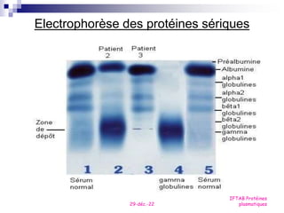 29-déc.-22
IFTAB Protéines
plasmatiques
Electrophorèse des protéines sériques
 