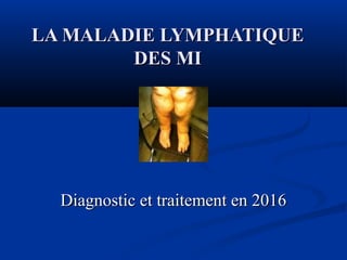 LA MALADIE LYMPHATIQUELA MALADIE LYMPHATIQUE
DES MIDES MI
Diagnostic et traitement en 2016Diagnostic et traitement en 2016
 