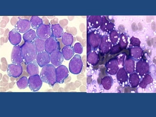 Oncologie pédiatrique Bamako/Mali
 