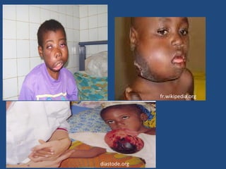 diastode.org
fr.wikipedia.org
 