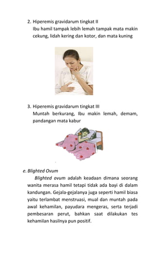 2. Hiperemis gravidarum tingkat II
Ibu hamil tampak lebih lemah tampak mata makin
cekung, lidah kering dan kotor, dan mata kuning
3. Hiperemis gravidarum tingkat III
Muntah berkurang, Ibu makin lemah, demam,
pandangan mata kabur
e. Blighted Ovum
Blighted ovum adalah keadaan dimana seorang
wanita merasa hamil tetapi tidak ada bayi di dalam
kandungan. Gejala-gejalanya juga seperti hamil biasa
yaitu terlambat menstruasi, mual dan muntah pada
awal kehamilan, payudara mengeras, serta terjadi
pembesaran perut, bahkan saat dilakukan tes
kehamilan hasilnya pun positif.
 