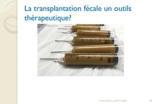 La transplantation fécale un outils
thérapeutique?
Franck Rencurel BTS 2020 84
 