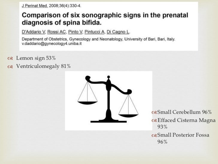 Lemon and Banana signs