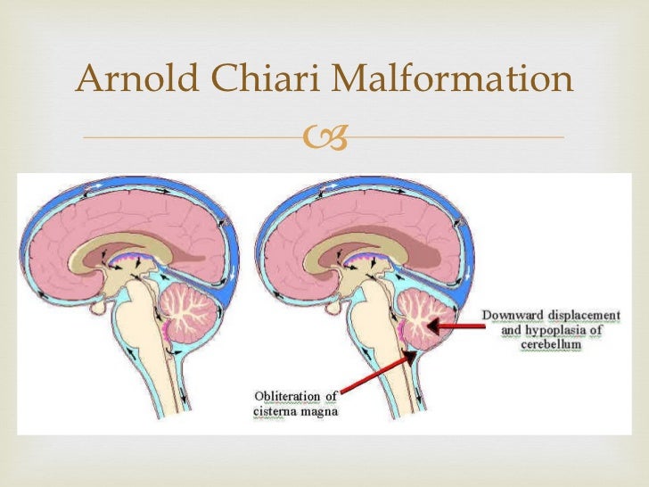 Lemon and Banana signs