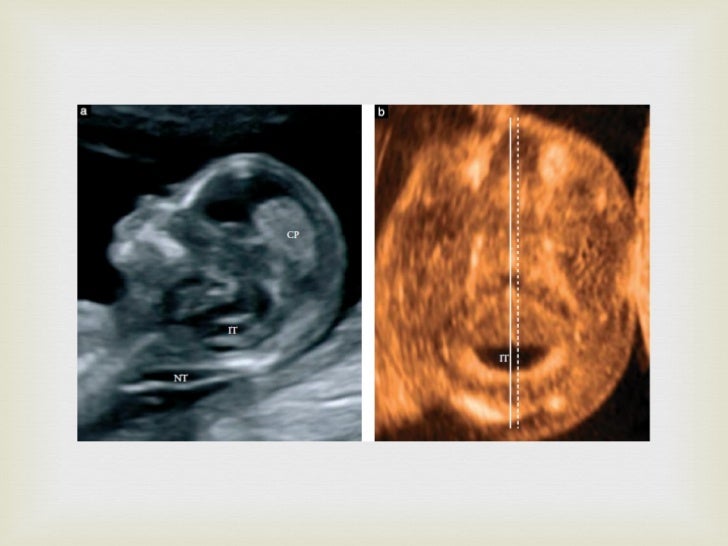 Lemon and Banana signs