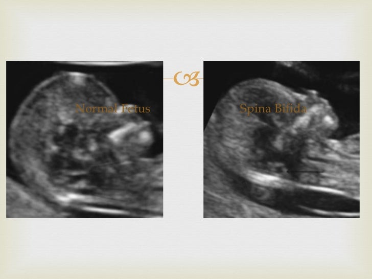 Lemon and Banana signs