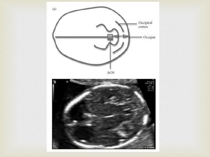 Lemon and Banana signs