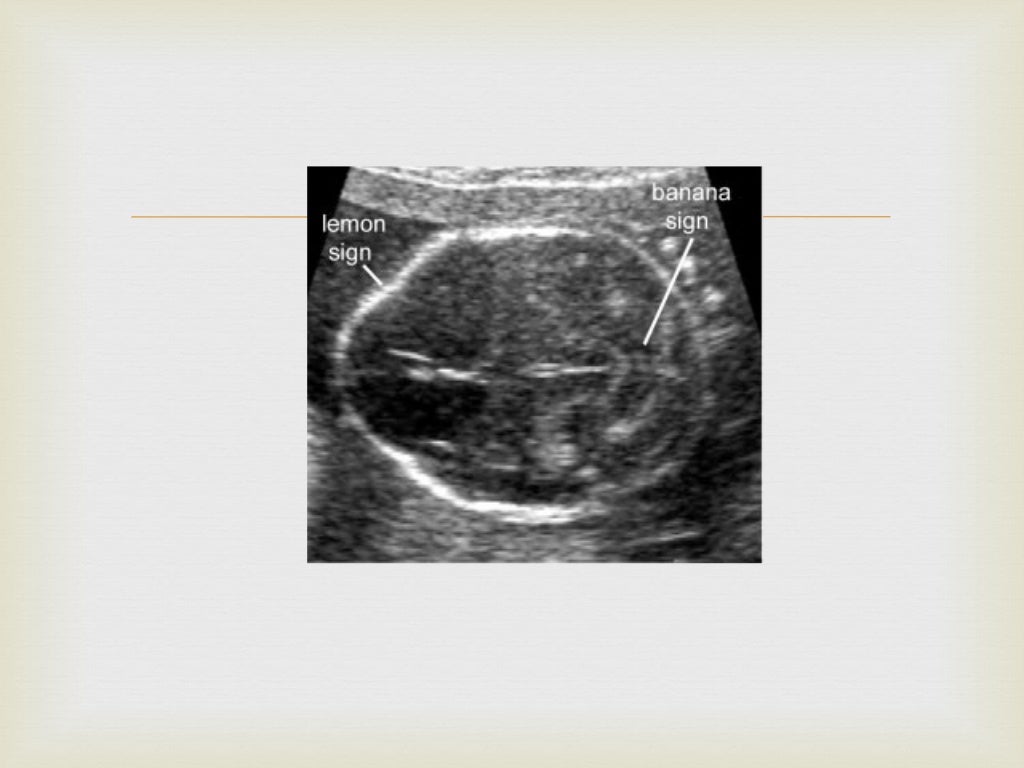 Lemon and Banana signs