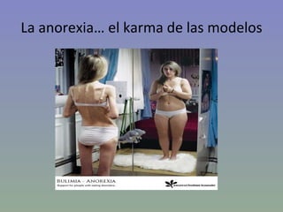 La anorexia… el karma de las modelos 