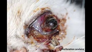 Perforation oculaire

 